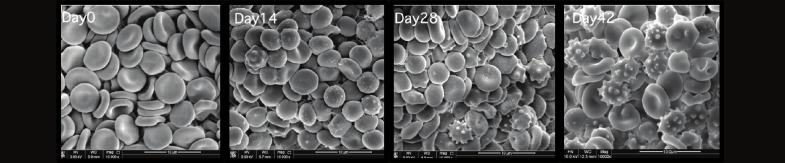 Red Blood Cell (RBC) Storage Lesions and Their Clinical Consequences